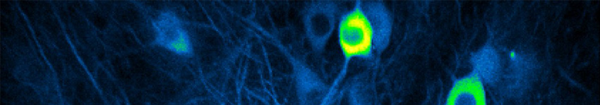 Baculovirus-Insect Cell Protein Expression