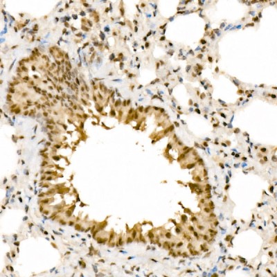 KO-Validated HNRNPA2B1 Rabbit pAb (20 μl)