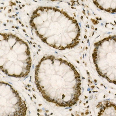 KO-Validated PTBP1 Rabbit pAb (20 μl)