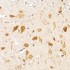 KO-Validated Smad1 Rabbit mAb (20 μl)