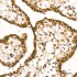 KO-Validated Smad4 Rabbit mAb (20 μl)