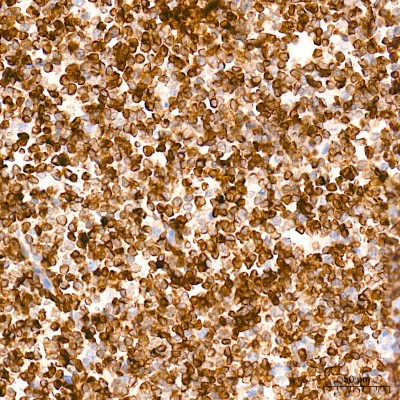KD-Validated Bcl-2 Rabbit mAb (20 μl)