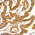 KO-Validated NF-kB p65/RelA Rabbit mAb (20 μl)