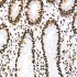 KO-Validated HDAC1 Rabbit mAb (20 μl)