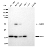 KD-Validated Bcl10 Rabbit mAb (20 μl)
