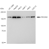 KD-Validated ROCK2 Rabbit mAb (20 μl)
