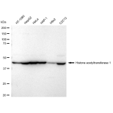 KD-Validated HAT1 Rabbit mAb (20 μl)
