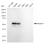 KD-Validated K7 Rabbit mAb (20 μl)