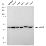 KD-Validated AdSS 2 Rabbit mAb (20 μl)
