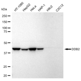 KD-Validated DDB2 Rabbit mAb (20 μl)