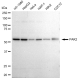 KD-Validated PAK2 Rabbit mAb (20 μl)