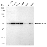 KD-Validated SMARCE1 Rabbit mAb (20 μl)