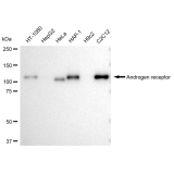 KD-Validated AR Rabbit mAb (20 μl)
