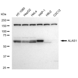 KD-Validated ALAS1 Rabbit mAb (20 μl)