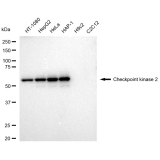 KD-Validated CHEK2 Rabbit mAb (20 μl)