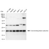 KD-Validated CBFB Rabbit mAb (20 μl)