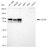 KD-Validated CD105 Rabbit mAb (20 μl)