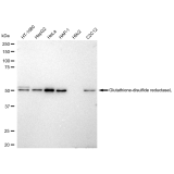 KD-Validated GSR Rabbit mAb (20 μl)