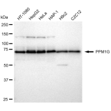 KD-Validated PPM1G Rabbit mAb (20 μl)