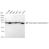 KD-Validated PRMT7 Rabbit mAb (20 μl)