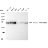 KD-Validated Phospho-RSK1 (S380) Rabbit mAb (20 μl)