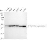 KD-Validated ACAA2 Rabbit mAb (20 μl)