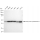 KD-Validated ACAA2 Rabbit mAb (20 μl)