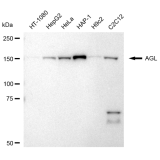 KD-Validated AGL Rabbit mAb (20 μl)