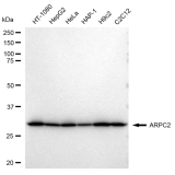 KD-Validated ARPC2 Rabbit mAb (20 μl)