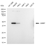 KD-Validated AMBP Rabbit mAb (20 μl)