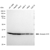 KD-Validated ANXA10 Rabbit mAb (20 μl)