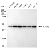 KD-Validated ATG4B Rabbit mAb (20 μl)