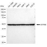 KD-Validated ATP5B Rabbit mAb (20 μl)