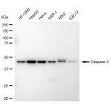 KD-Validated CASP2 Rabbit mAb (20 μl)