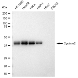 KD-Validated CCNE2 Rabbit mAb (20 μl)