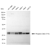 KD-Validated Phospho-Cdk2 (Y15) Rabbit mAb (20 μl)