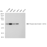 KD-Validated Phospho-ARRB1 (S412) Rabbit mAb (20 μl)