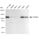 KD-Validated SPINK5 Rabbit mAb (20 μl)