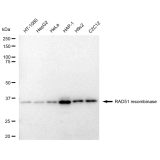 KD-Validated RAD51 Rabbit mAb (20 μl)