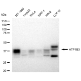 KD-Validated ATP1B3 Rabbit mAb (20 μl)