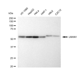 KD-Validated LMAN1 Rabbit mAb (20 μl)