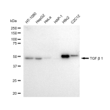 KD-Validated TGFB1 Rabbit mAb (20 μl)