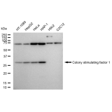 KD-Validated CSF1 Rabbit mAb (20 μl)