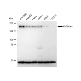KD-Validated EIF2AK4 Rabbit mAb (20 μl)