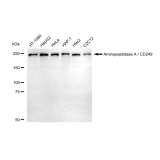 KD-Validated CD249 Rabbit mAb (20 μl)
