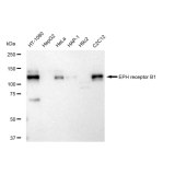KD-Validated EPHB1 Rabbit mAb (20 μl)