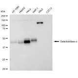 KD-Validated GLA Rabbit mAb (20 μl)