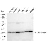 KD-Validated GLO1 Rabbit mAb (20 μl)