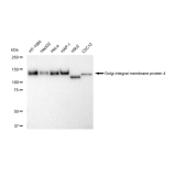 KD-Validated GOLIM4 Rabbit mAb (20 μl)
