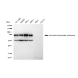 KD-Validated GPI Rabbit mAb (20 μl)